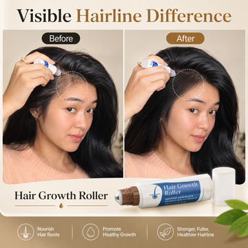 RootRevive Scalp Growth Roller